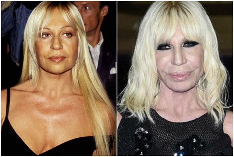 donatella versace prima del bisturi|donatella versace and gianni.